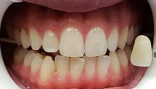 Smile Gallery Photo