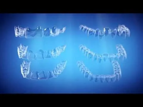 Straight Talk About Crooked Teeth - Invisalign